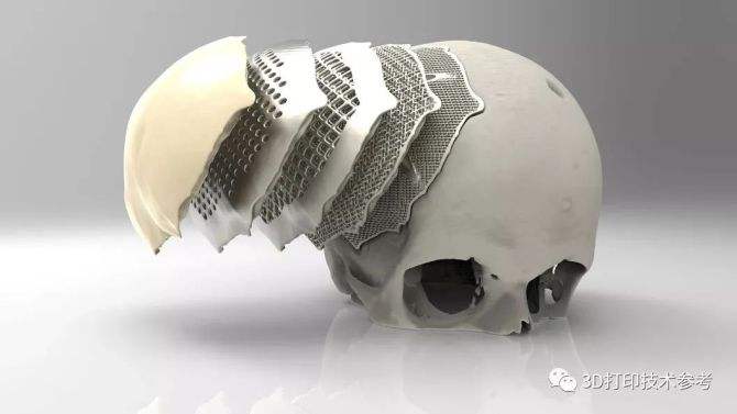 钛合金3D打印技术